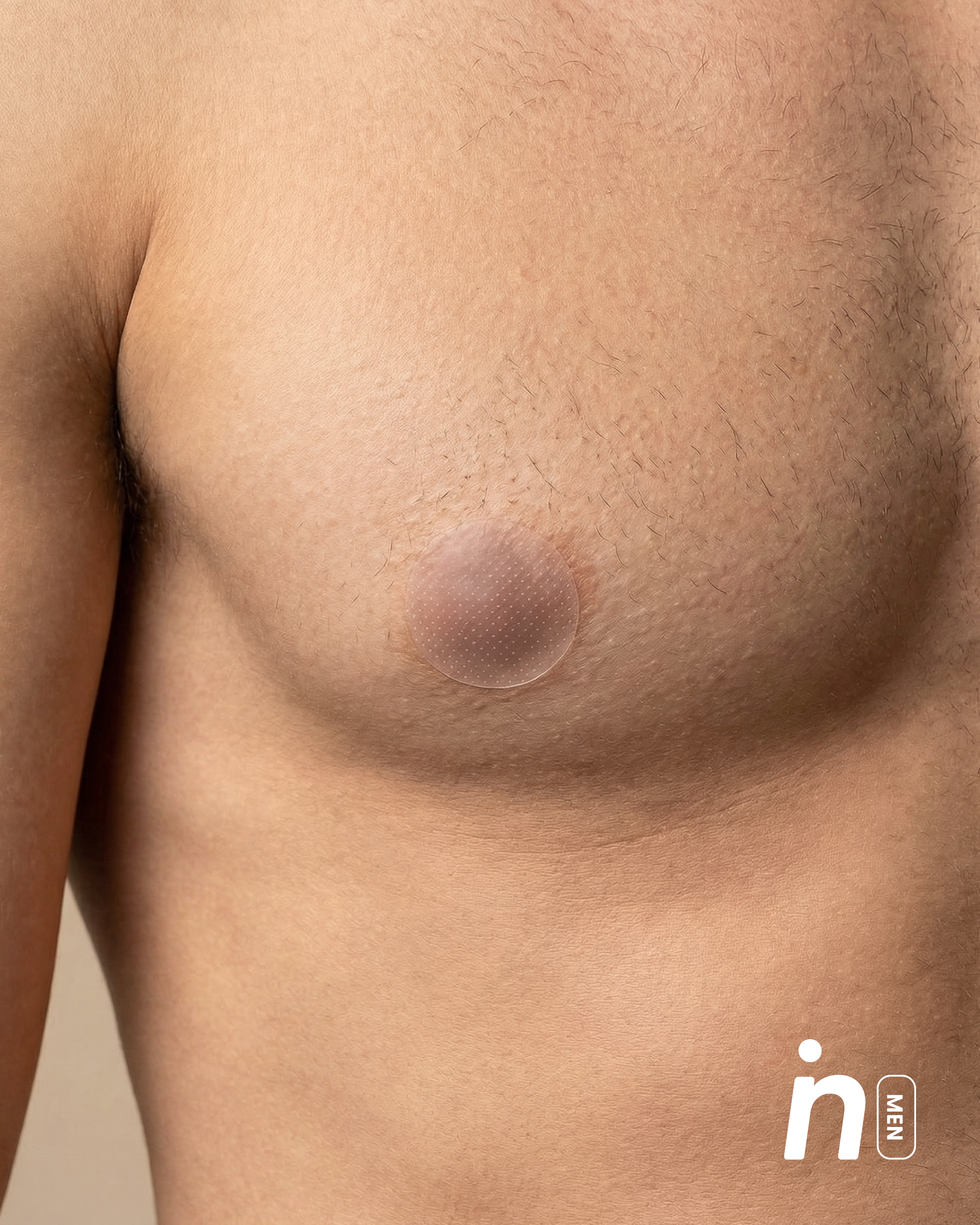 Protector de Pezón Anti-Roce (Pack x10 pares), Chase the Win - Nipskin®