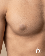 Kit Cubrepezones Pareja: Anti - Roce (Él) + Sin Adhesivo (Ella) - Nipskin®