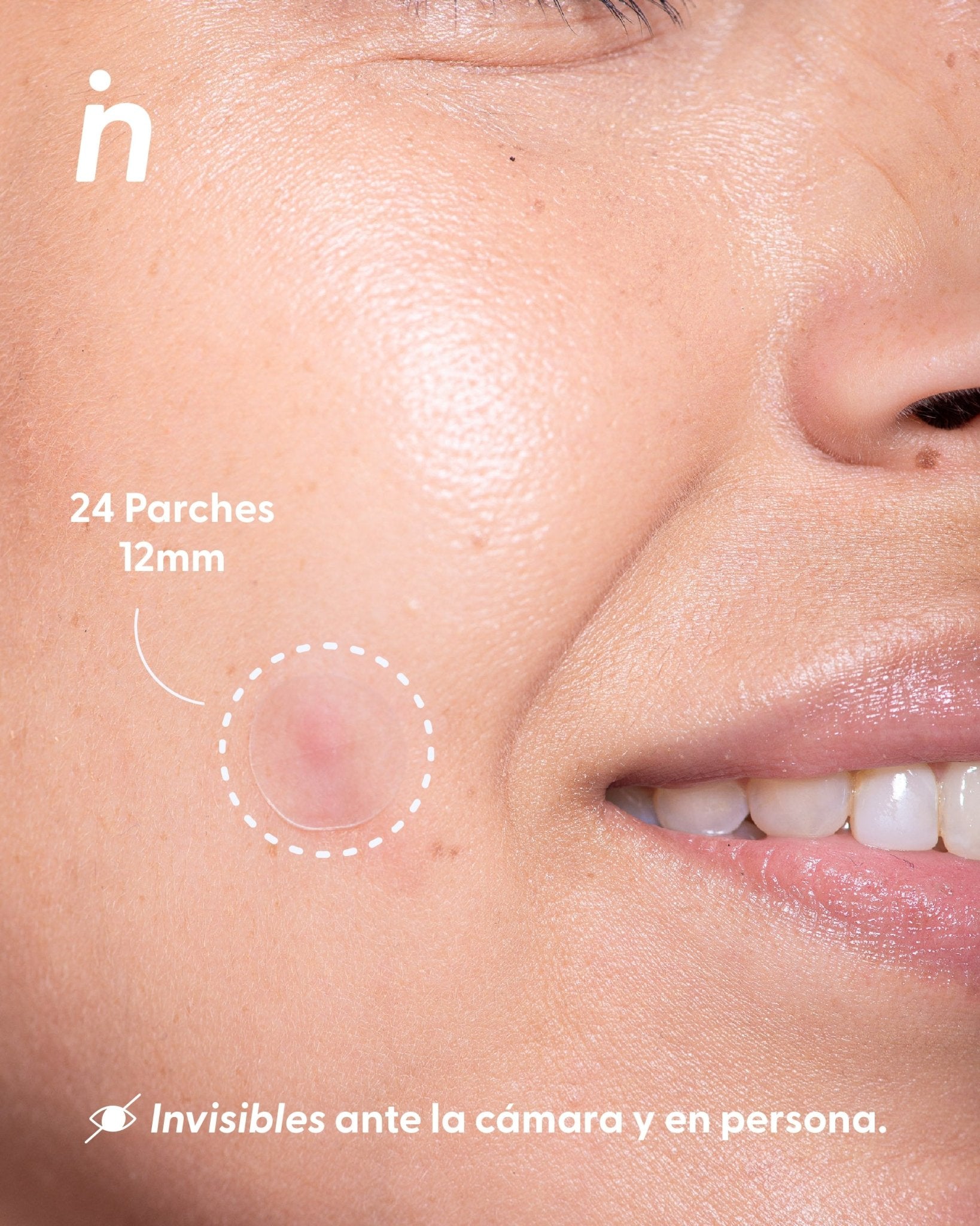 Parches de Hidrocoloide para Granos x2 - Nipskin®