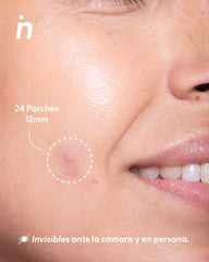 Parches de Hidrocoloide para Granos x2 - Nipskin®