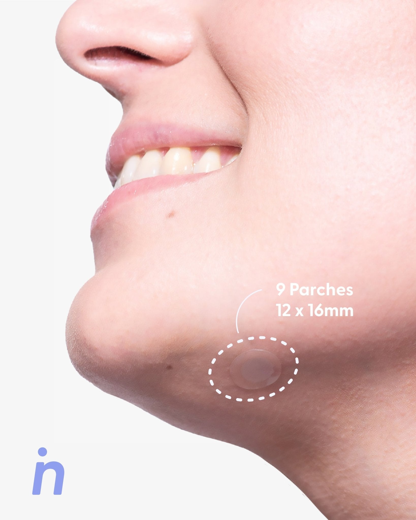 Parches para Granos más Estuche, Pimple Patches  - Nipskin®
