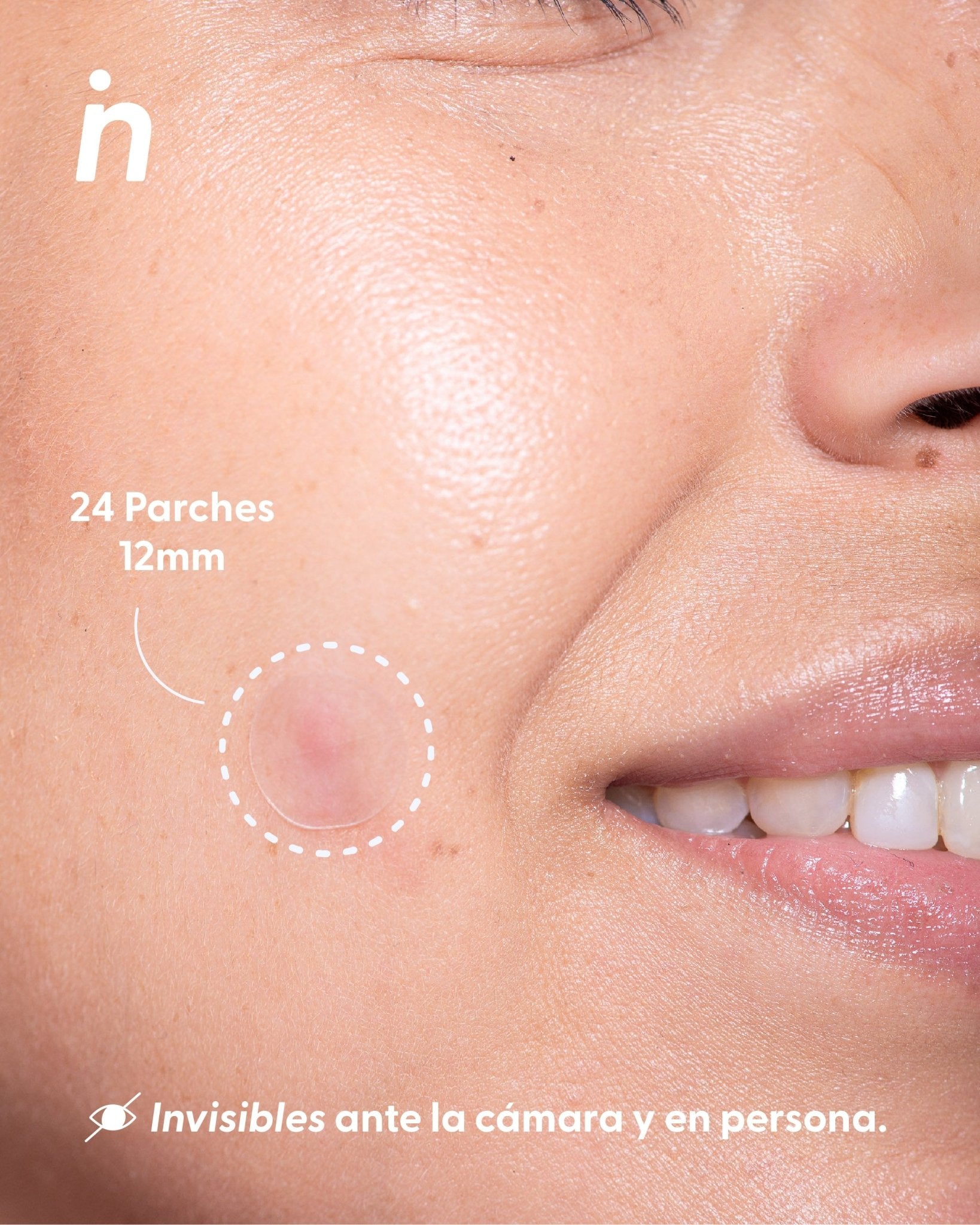 Parches para Granos más Estuche, Pimple Patches  - Nipskin®